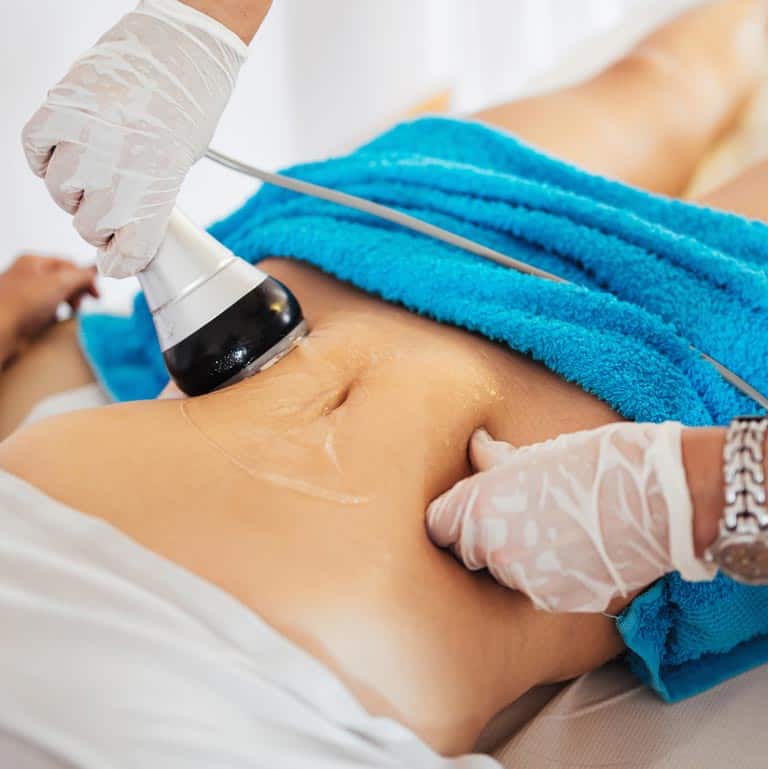 Woman receiving a cool sculpting treatment by someone wearing latex gloves with a blue towel draped across her.